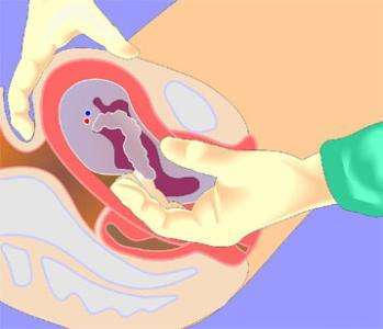 自然分娩过程中的痛苦,自然顺产和剖腹产对产道的影响