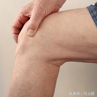 治疗膝关节骨性关节炎的正确姿势,怎样减缓膝关节骨性关节炎的发展