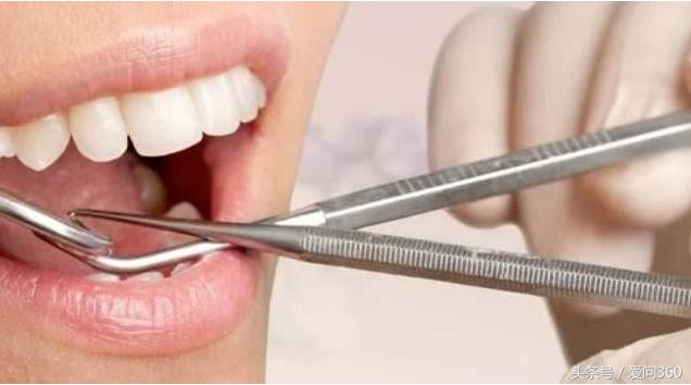 牙疼的要命谁有办法,牙疼要命咋办