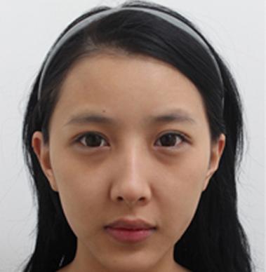 眼袋对形象影响有多大?看看你就都知道了!