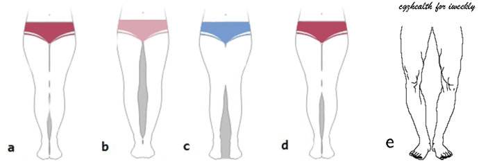 我腿粗但是挡不住我会穿啊