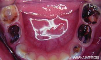 突然牙疼警惕四种病,牙疼不算病的句子