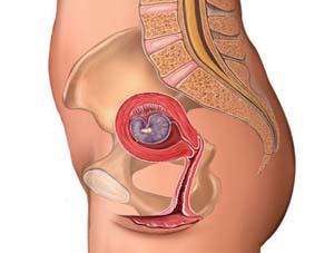 孕早期症状有哪些如何自我检测,孕早期后背疼痛怎么回事