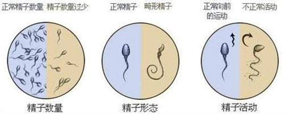 怀不上宝宝有原因，却也不能草木皆兵！快来给火锅丸子平反