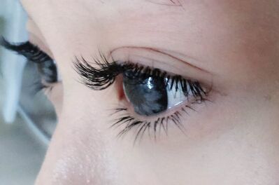 眼睫毛进入眼睛有什么伤害,植睫毛对眼睛有什么影响