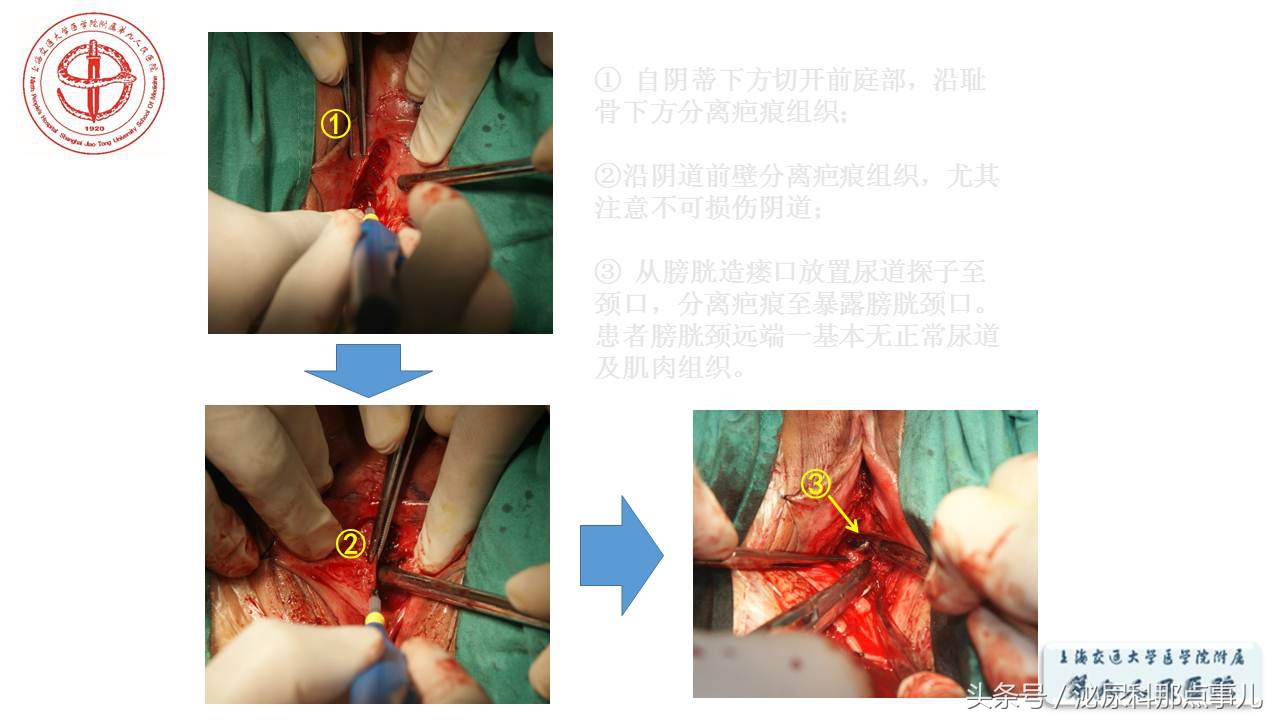 泌尿男科王忠教授,泌尿外科专家王忠教授