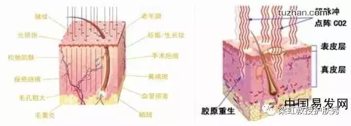 雀斑中性风妆容,简单又好看的雀斑妆