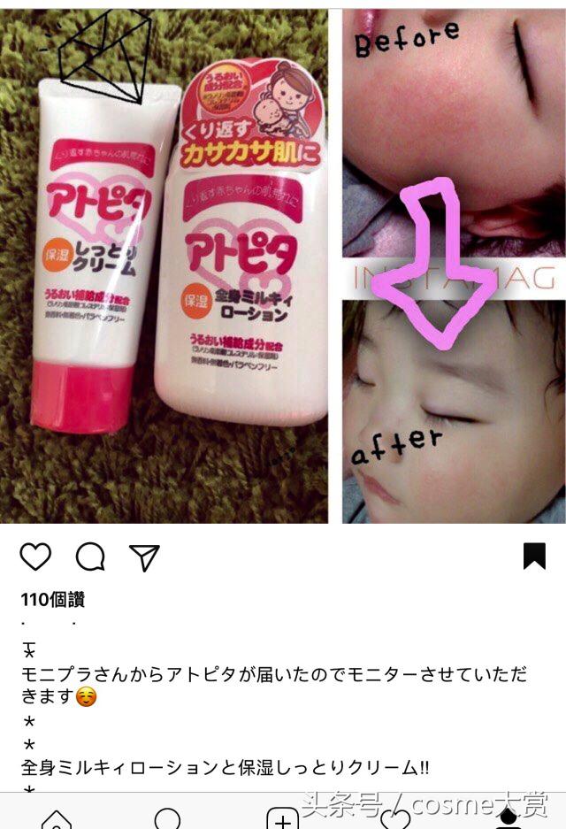 日本婴儿湿疹好药推荐,日本好用的宝宝治湿疹膏