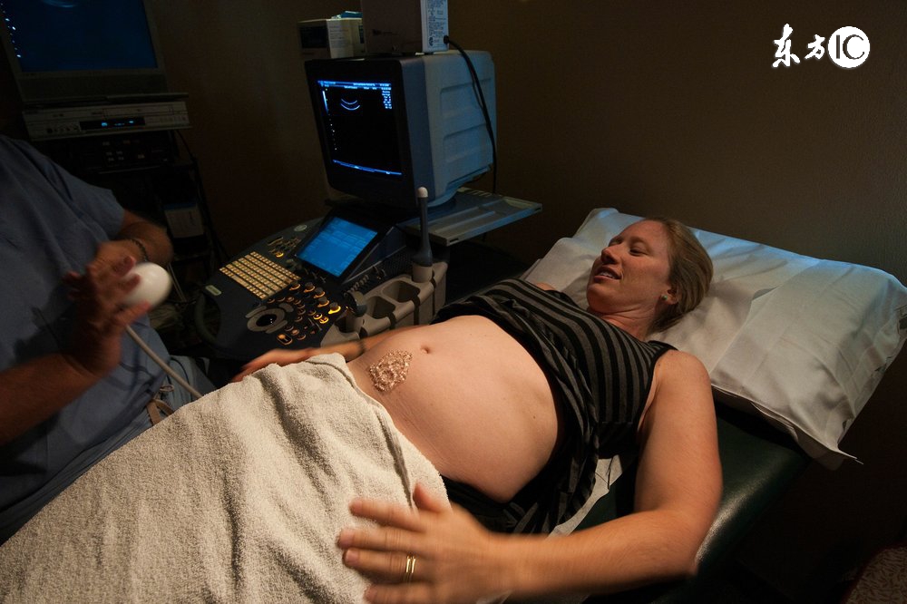 孕8月有哪些生理症状,孕晚期遇到这5件事