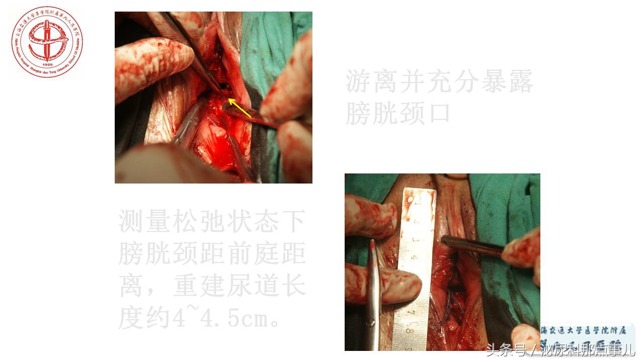 泌尿男科王忠教授,泌尿外科专家王忠教授