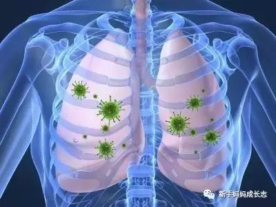 新生儿科的医生怎么治疗肺炎,医生如何诊断儿童肺炎