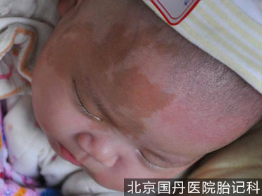 喝咖啡会长,喝咖啡真的会长斑吗