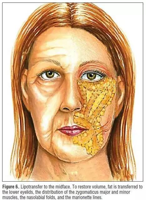 新垣结衣怎么那么像中脸型,为什么新垣结衣傻白甜得这么可爱