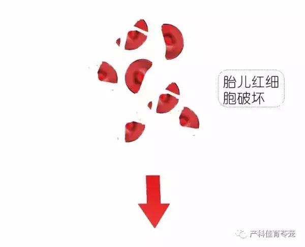 熊猫血的人可以二次怀孕吗,熊猫血女性怀孕打什么针