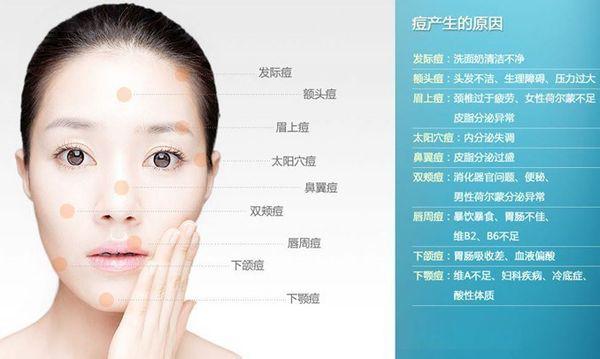 被痘痘困扰好几年的朋友福音,有痘痘烦恼的朋友们看过来