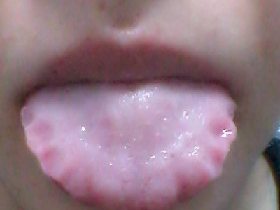 女性出现什么症状需要警惕,女性身体出现这些异样表现