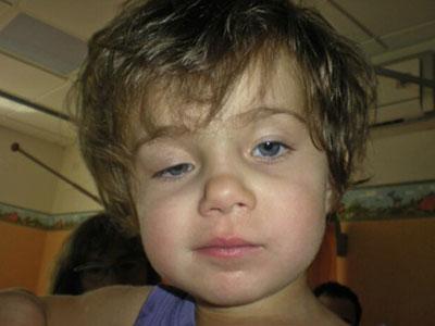 小宝宝一只双眼皮，一只单眼皮，是影响美观？还是眼睛在求救？