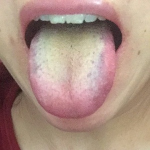 十人九湿湿气除百病消是真的吗,十人九湿湿气不除