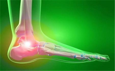 很费鞋的1种病,跑、跳、走、站都特累,预防很重要