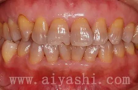 我们的牙齿是怎么来的,我们的牙齿是哪来的