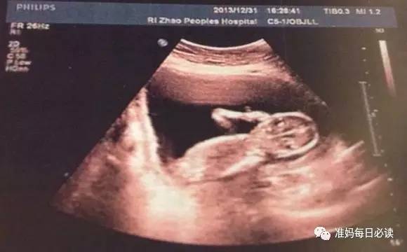 “看星星的宝宝”该怎么通过产道？分娩真是一门大学问！
