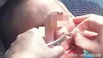 它竟然在孩子的身体里发芽，头疼鼻子疼千万别大意