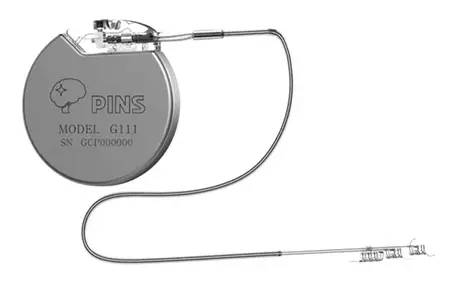 迷走神经刺激术针对哪类癫痫,迷走神经刺激术治疗癫痫效果
