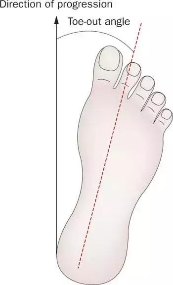 八字脚跑步对身体有什么影响,跑步怎么纠正外八字脚