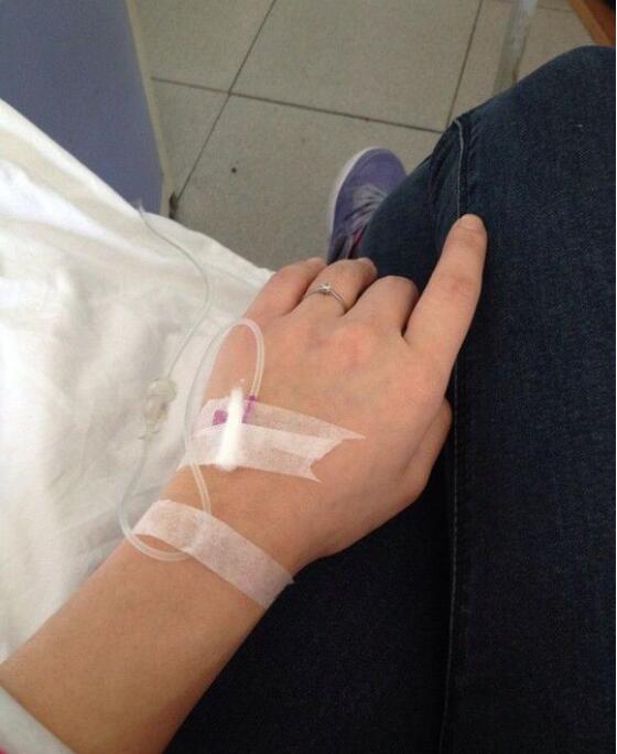 完美的埋线双眼皮,完美双眼皮