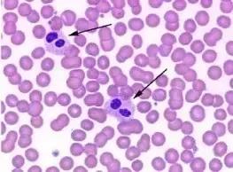 外周血细胞涂片的正常值,外周血细胞分析多长时间出结果