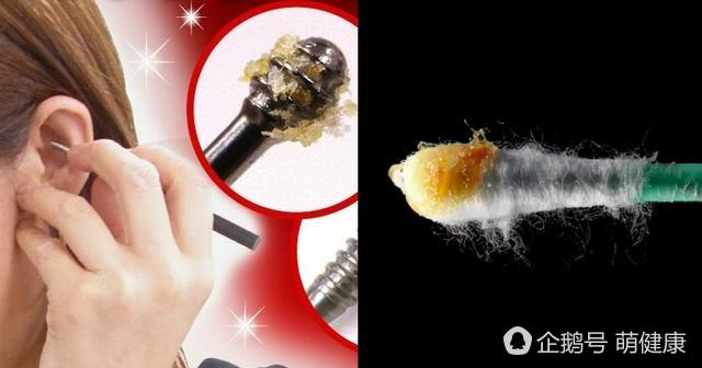 耳朵痒痛要警惕早期症状,脖子后耳朵痒是癌症的前兆