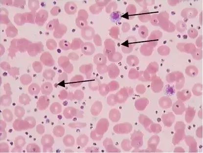 外周血细胞涂片的正常值,外周血细胞分析多长时间出结果