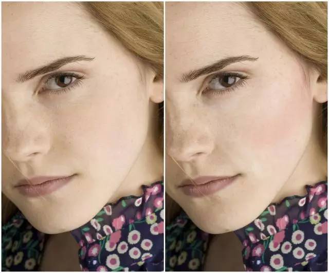 美女与野兽|天生法令纹只能靠整容吗?那是因为你没看这篇!