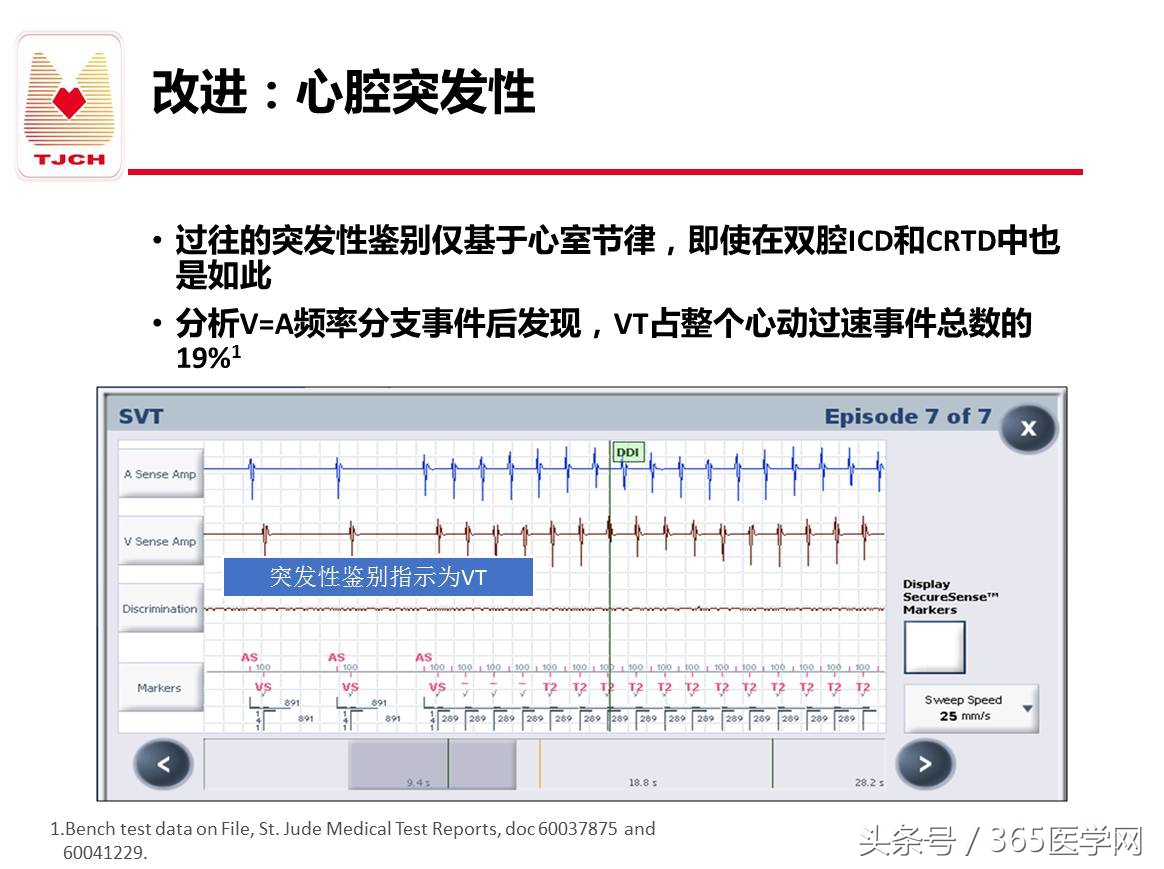 许静：新技术避免ICD不恰当放电