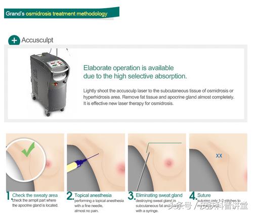 夏天腋臭怎么去除最快,祛除腋臭最彻底的治疗方法