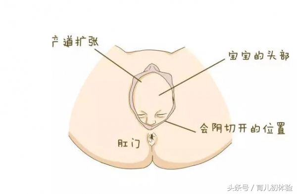 顺产也要挨一刀？一定要侧切吗？