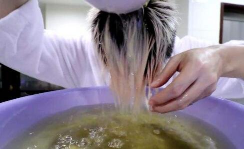 严重的头皮屑怎么也去不掉怎么办,头皮屑一直去不掉怎么办