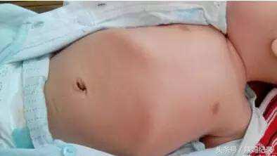 宝宝肋骨外翻怎么办?给宝妈们分享亲身经历