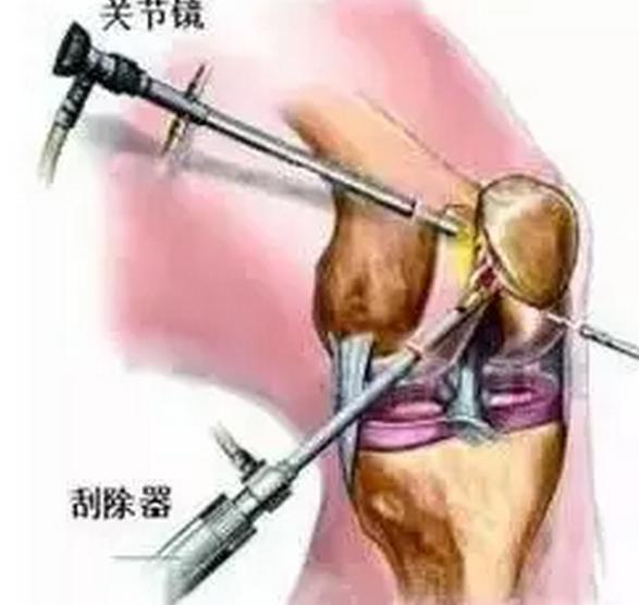 乍暖还寒注意预防感冒,乍暖还寒谨防感冒