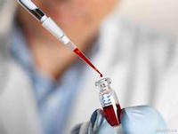 胸腺瘤第8版分期指南,内科学霸笔记