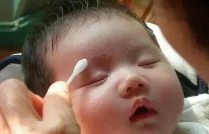 宝宝脸上有奶癣湿疹怎么好得快,婴儿脸上红色的点是湿疹还是奶癣