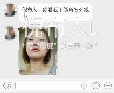 下颌角削多了变成马脸怎么修复,下颌角削骨有哪几种切法