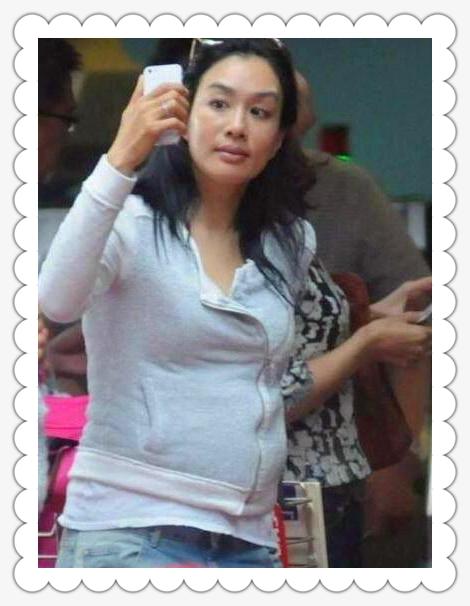 钟丽缇美白针,钟丽缇刮痧脸部