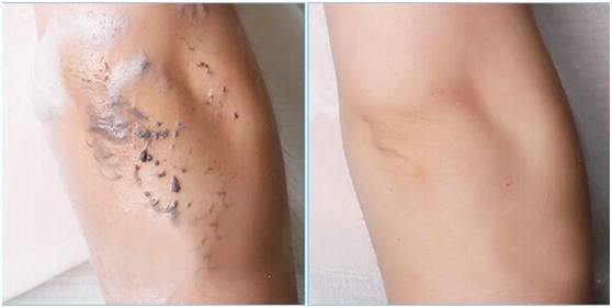 冬季美白秘籍推荐,美白最有效的单品