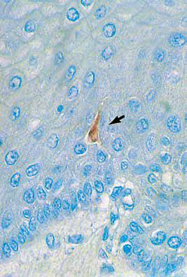 内镜做病理分析大概多久,作为一个医生太感性怎么办