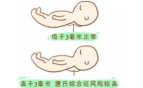 整个孕期所有产检的详细的书,产检全攻略快收藏起来