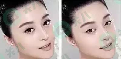 达康书记梁朝伟刘青云,达康张雨绮