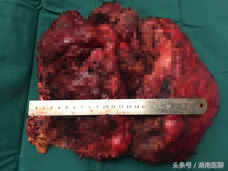 湖南一女子超市偷东西,湖南女子偷东西案