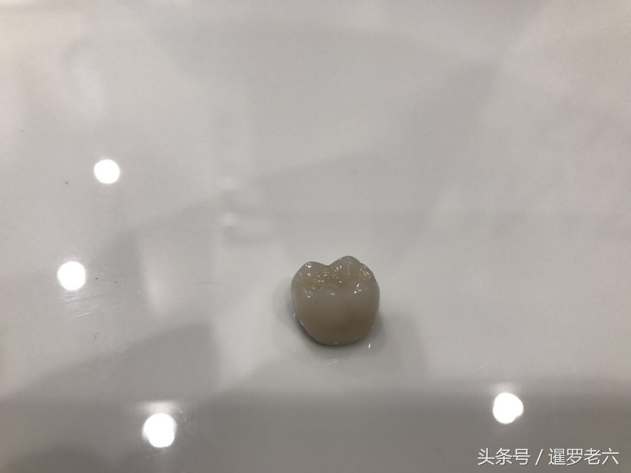 泰国曼谷医院补牙哪家好,在泰国曼谷做美白牙齿价格多少