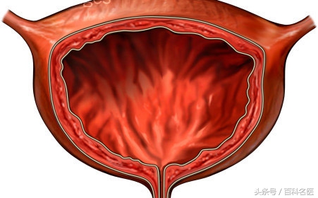 尿不尽有什么小方法治愈,尿不尽怎么治疗最快的方法